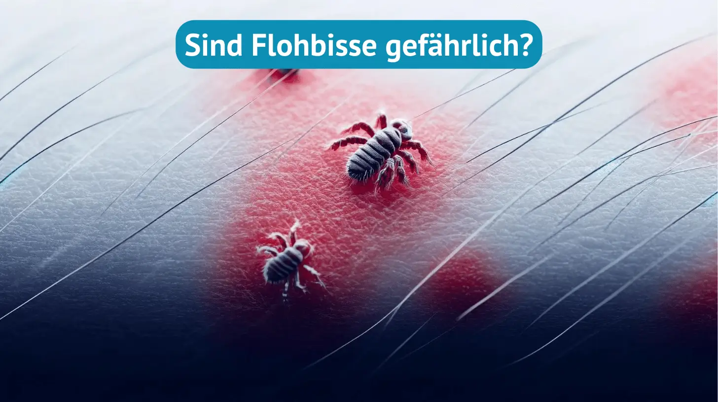 Flohbisse gefährlich für die Gesundheit